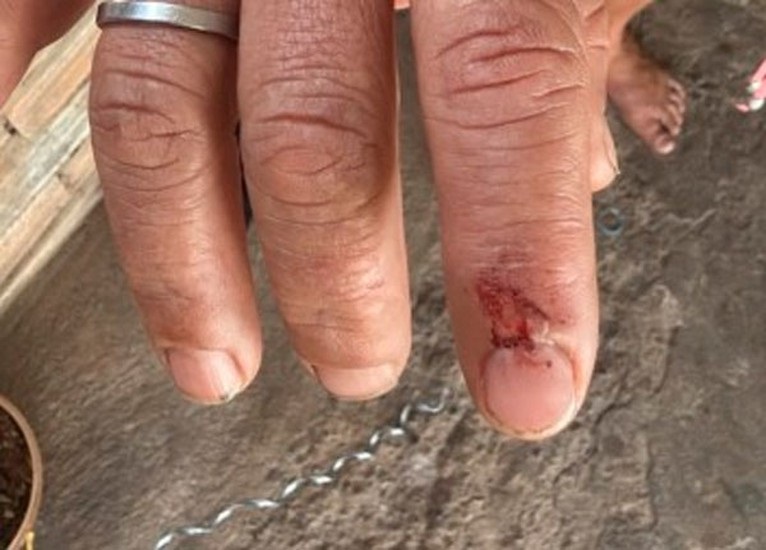 Homem é preso após agredir companheira com pedaço de madeira e tentar fugir da Polícia em Patos de Minas